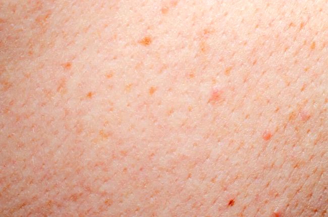 yeHnA4185hr8aj9i.jpg yeHnA4185hr8aj9i.jpg